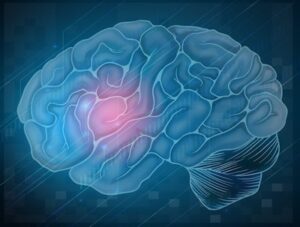 NeurOptimal Brain Training System