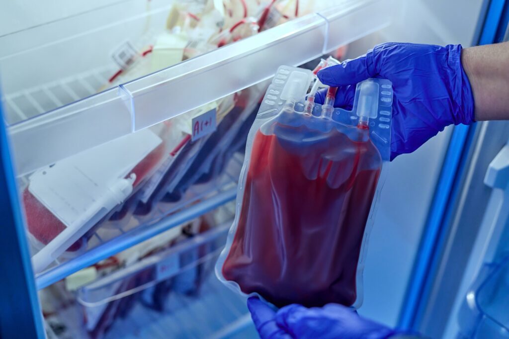 Platelet Rich Plasma Therapy & Injections: Complete Guide